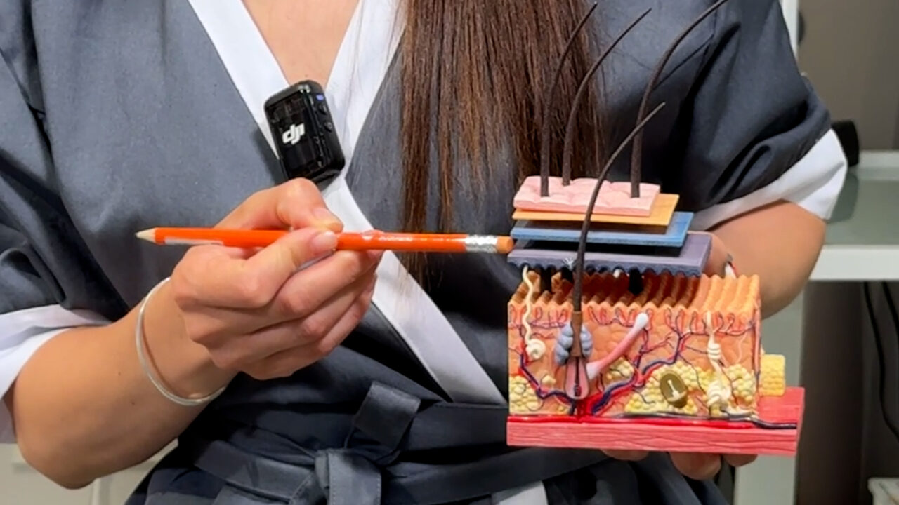 Косметолог в Таллинн рассказывает, чем опасны уколы красоты и филлеры